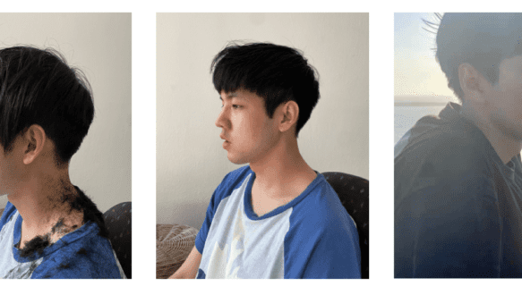 13 细软发 韩式修剪